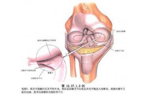 運(yùn)動醫(yī)學(xué)（關(guān)節(jié)鏡）?？? title=